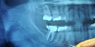 14,000 people wait over a year for dental screening in Galway Galway Daily news 14,000 waiting for dental screening in Galway