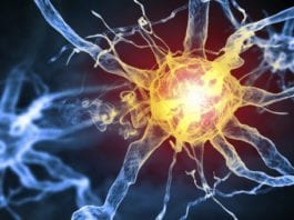 Galway Daily news NUIG leads €4 million project seeking new Multiple Sclerosis treatments