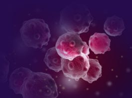 Galway News - NUIG pioneers breast cancer treatment