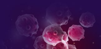 NUIG makes gentic breakthrough on breast cancer survival rates Galway News - NUIG pioneers breast cancer treatment