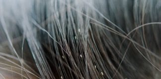 Pharmacists issue call to arms against head lice as school year begins Galway Daily life & style pharmacists warn against head lice as school year begins