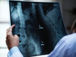 Galway Daily news Criticism levelled at slow delivery of Tuam X-Ray facilities