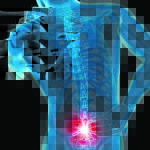 back pain physiotherapy