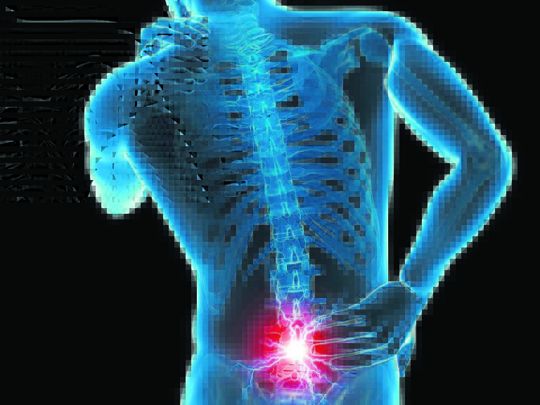 Lower back pain in the sights of €15 million research project - Galway ...