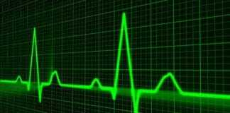 University of Galway reports successful “first in human” trial of pioneering guidance for heart bypass surgery Galway Daily news