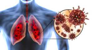 NUIG research deepens understanding of COVID-19 infections Galway Daily news NUIG research deepens understanding of COVID-19 infections