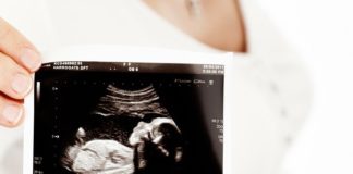 Call for national alignment on maternity restrictions galway daily news anomaly scan baby university hospital galway