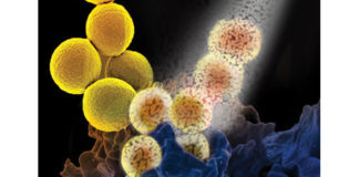 NUIG study finds vulnerability in antibiotic resistant superbug MRSA Galway Daily news NUIG study finds vulnerability in antibiotic resistant superbug MRSA