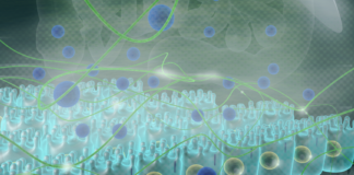 NUI Galway research will advance treatment of Crohn’s disease galway daily news nui galway CÚRAM research crohns disease