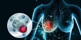 Galway researchers make major breakthrough in study of aggressive breast cancer galway daily news breast cancer research nui galway researchers