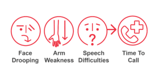 CroĆ urges people to act FAST and know the signs of stroke galway daily news croĆ world stroke day event galway